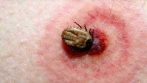 Ako nebezpečné chyby pre človeka