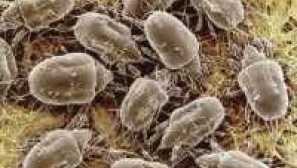 Demodekóza. Príčiny, príznaky, príznaky, diagnostika a liečba patológie