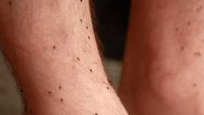 Aké sny blchy sú významom snov, ako správne rozlúštiť váš spánok