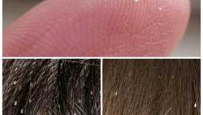 Ako odstrániť blchy od psa ľudovým opravnými prostriedkami najúčinnejšie spôsoby!