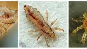 Pektilné značky, liečba a prevencia