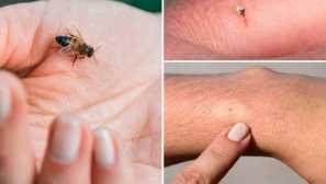 Aký je rozdiel medzi včelami, osami a čmeliakmi? Ako vyzerá včela?