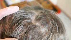 Vývoj hlavy kľúčov, reprodukcie ako nebezpečné, chodníky infekcie, metódy boja